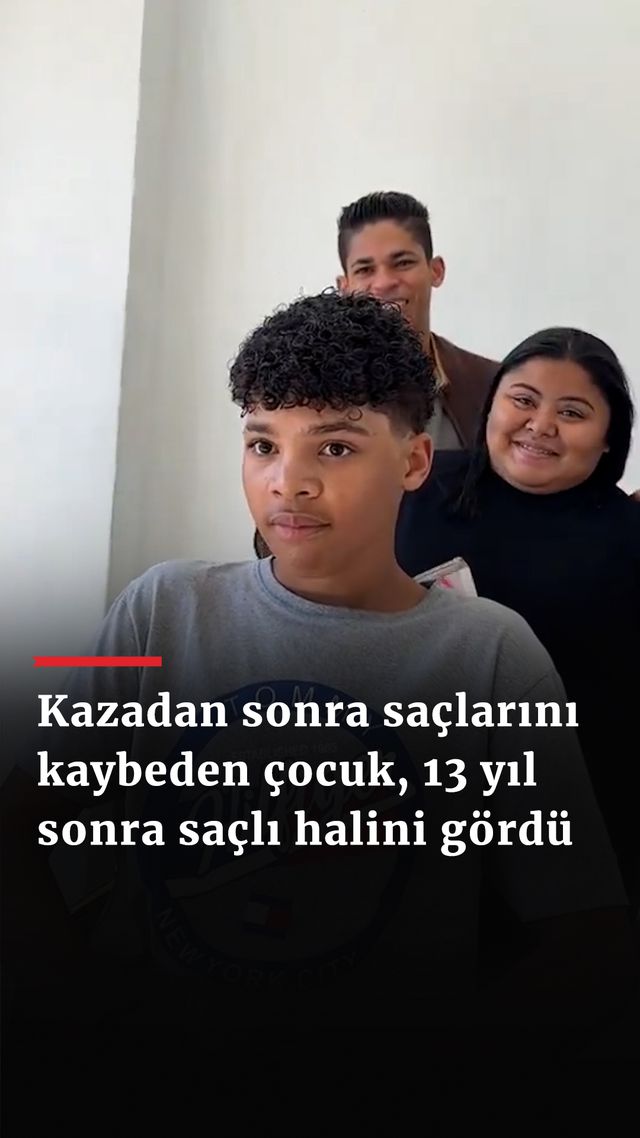 https://foto.haberler.com/haber/2024/08/24/kazadan-sonra-saclarini-kaybeden-cocuk-13-yil-sonra-sacli-halini-gordu_9147_o.jpg