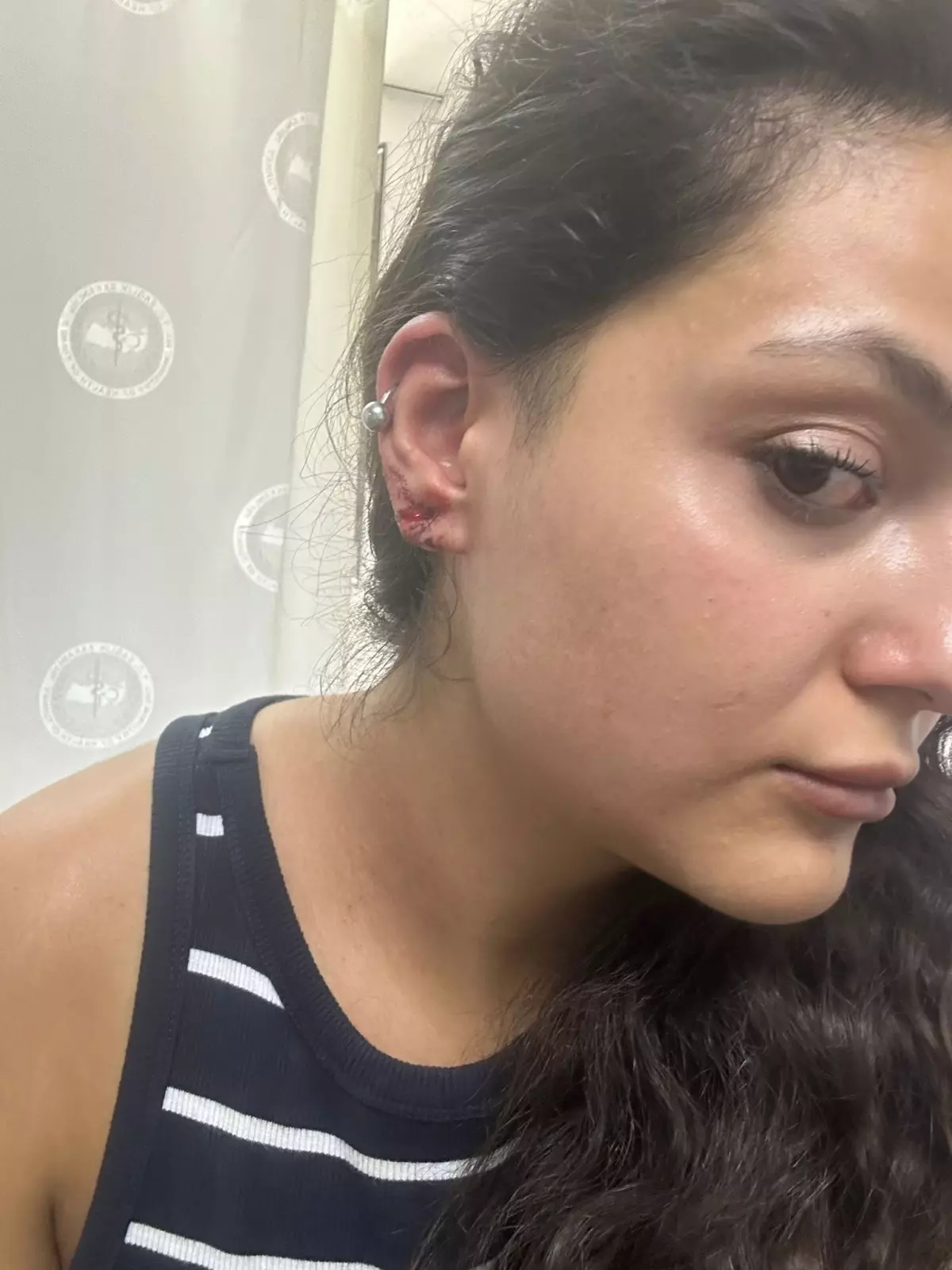 Yalova Muhabiri Saldırıya Uğradı