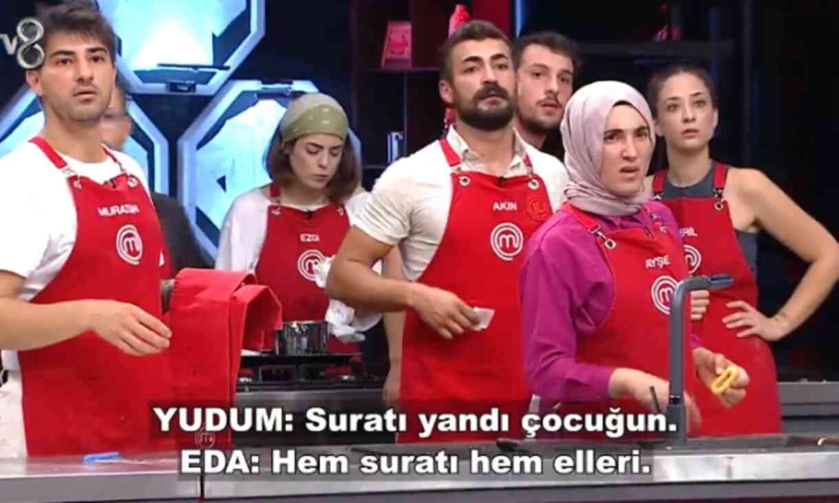 MasterChef Onur yüzü yandı mı? MasterChef 11 Eylül Çarşamba kızgın yağ kazasını kim yaptı, Onur'a ne oldu? MasterChef Onur yüzü yandı mı? MasterChef 11 Eylül Çarşamba kızgın yağ kazasını kim yaptı, Onur'a ne oldu?