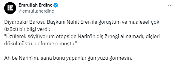 Печальная правда о Нарин! Не удалось взять образец зубов на вскрытии из-за их выпадения