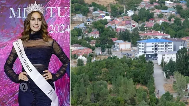 The district of Yayladere is eagerly awaiting the arrival of Turkey's Beauty doctor, İdil Bilgen.