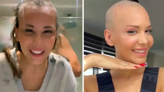 The famous singer Şimal, whose illness has relapsed, shaved her head.