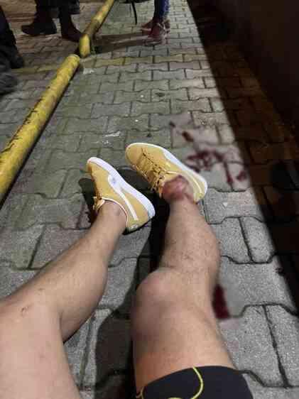 Serhat Akın neden vuruldu? Olay ne, ne oldu? Serhat Akın neden vuruldu? Olay ne, ne oldu?