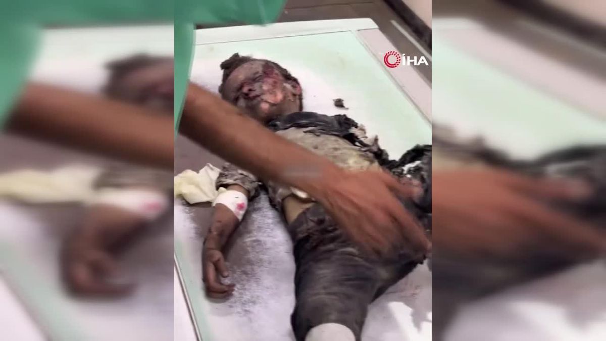 İsrail'in Gazze'deki Saldırılarında 12 Kişi Hayatını Kaybetti