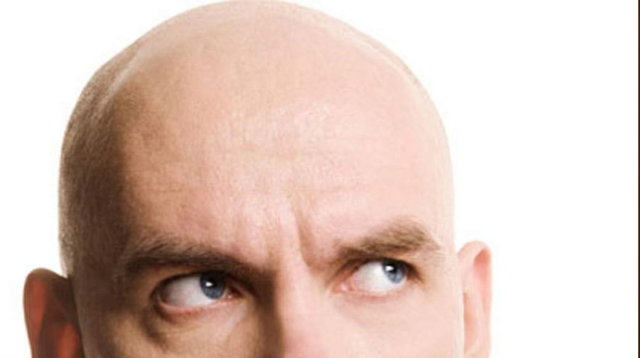 Precedent decision made: The term 'bald' was considered sexual harassment