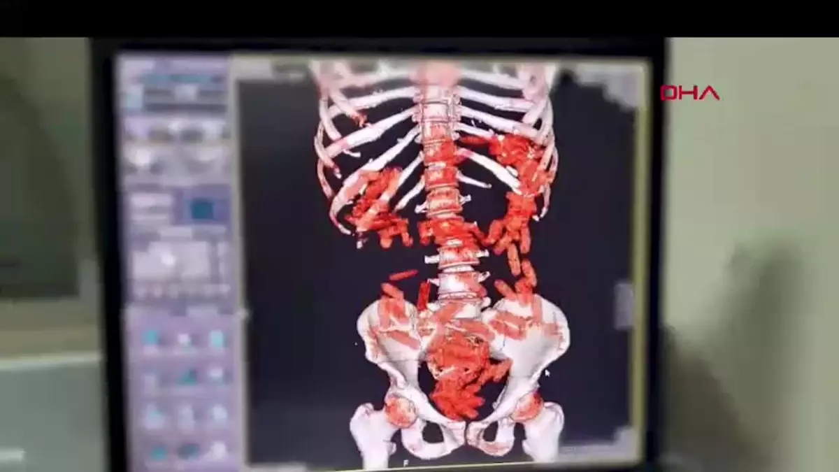 Kayseri'de Uyuşturucu Operasyonu: 2 Kişi Tutuklandı