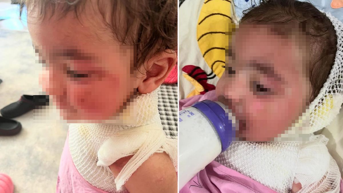 Kreşte 'kahve' faciası! Sapasağlam bıraktığı bebeğini, yanıklarla teslim aldı