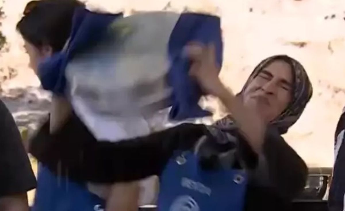 MasterChef Beyza'ya ne oldu, yüzü yandı mı?