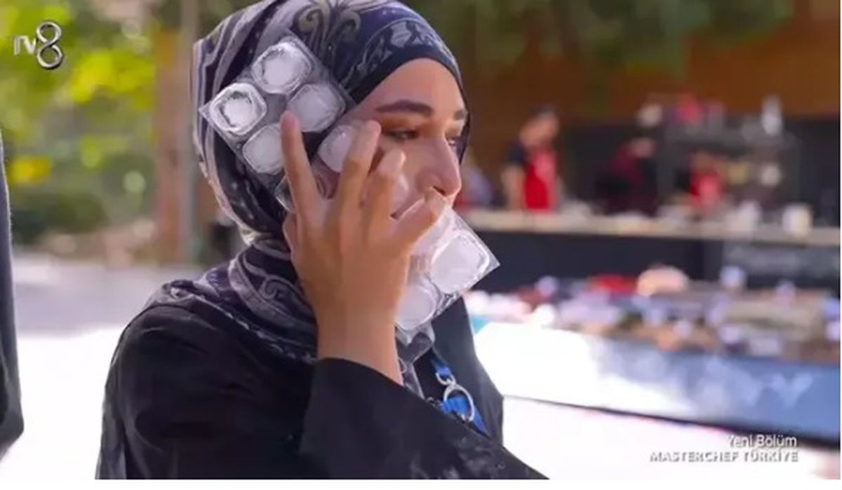 MasterChef Beyza son hali! Beyza'nın yüzü iyileşti mi?