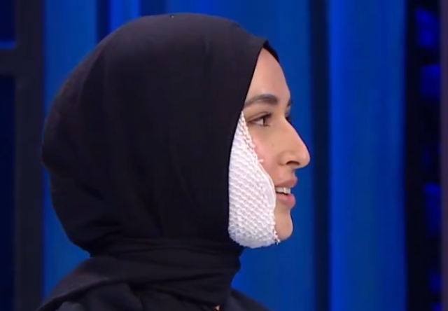 MasterChef Beyza yüzünde iz kalacak mı, son hali nasıl?