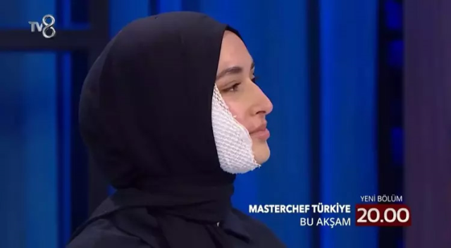 Beyza's latest condition after her face was burned on Masterchef