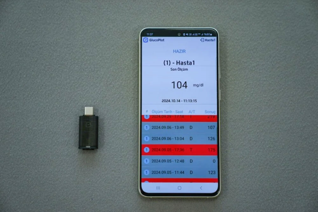 A Major Step by Turkish Scientists: The Ability to Measure Blood Sugar with a Mobile Phone!