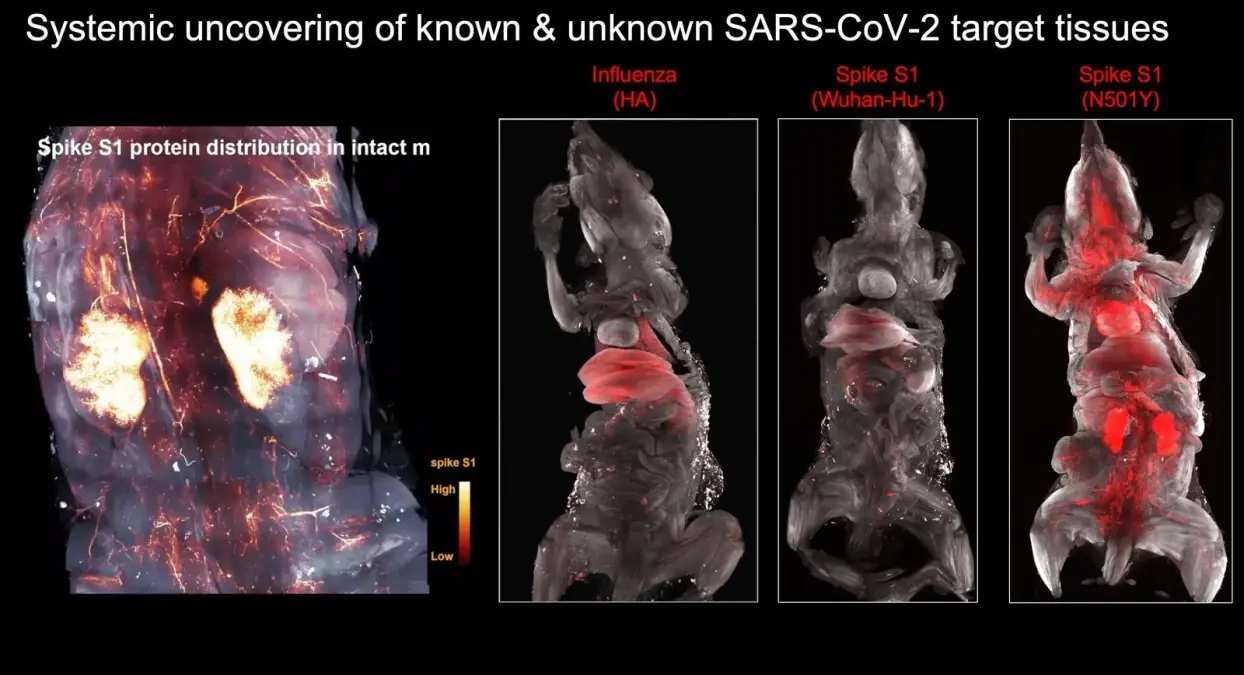 Türk profesörün araştırması: Covid-19 kafatasında bekleyip beyne sinsice sızıyor