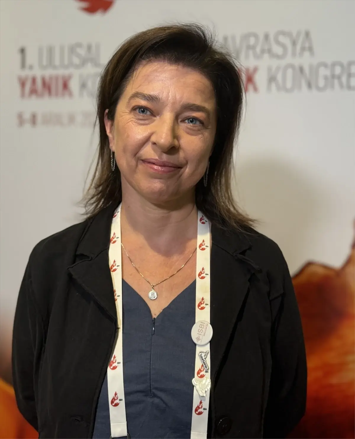 Türkiye, Yanık Tedavileri Konusunda Bölgesinde Referans Ülke