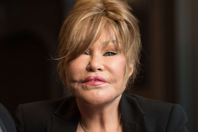 Jocelyn Wildenstein, known as 'Cat Woman', has passed away