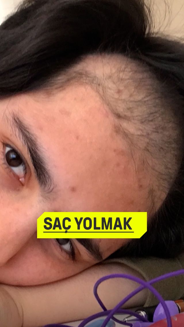 https://foto.haberler.com/haber/2025/01/06/neden-saclarimizi-yoluyoruz_1515_o.jpg