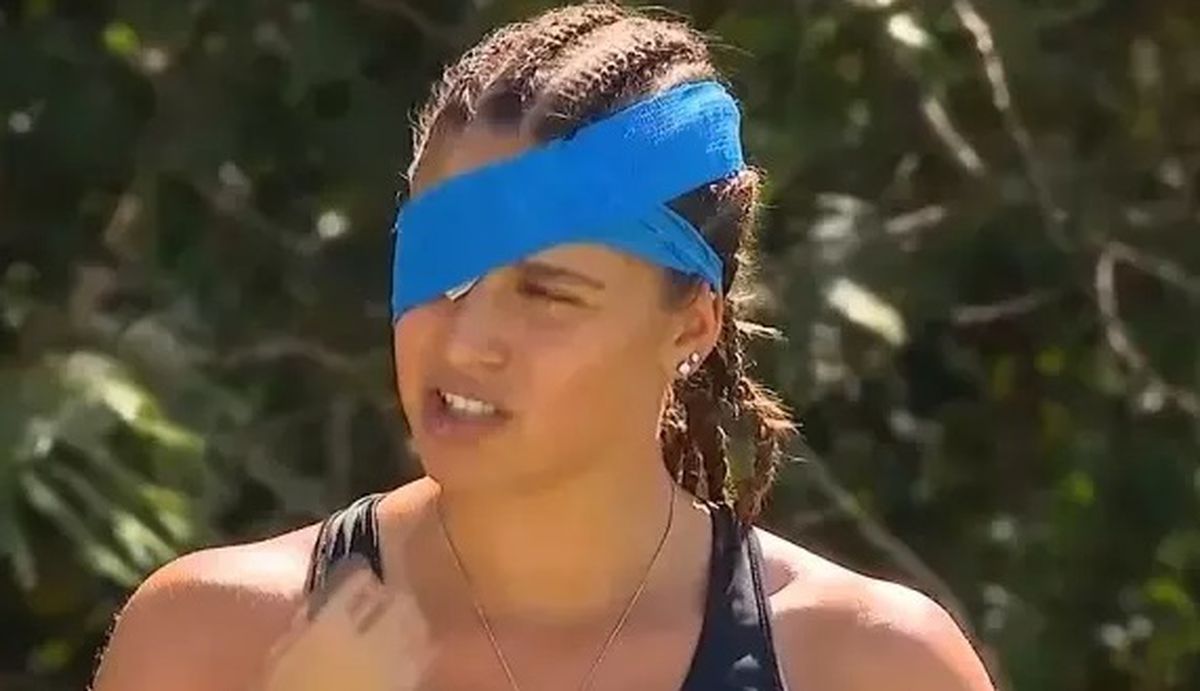 Survivor Ayşe gözüne ne oldu, neden gözünde mavi bandaj var?