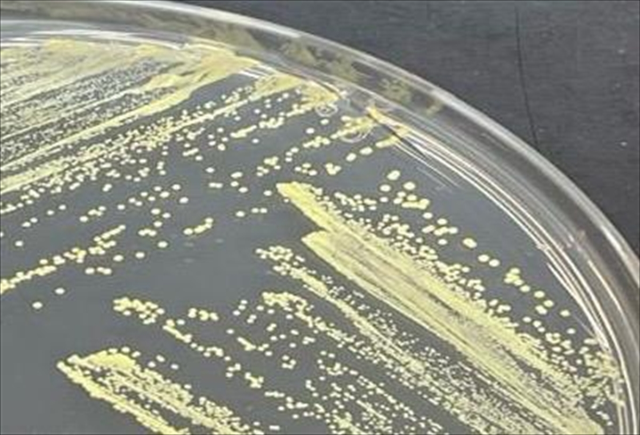 Breakthrough Discovery by Turkish Scientists: A New Genus of Bacteria Identified