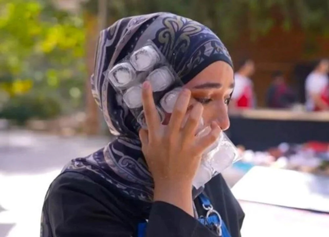 MasterChef Beyza shared a photo of her burned face with the note 'Sensitive content'