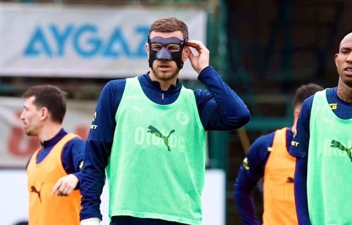 Dzeko neden maske takıyor?