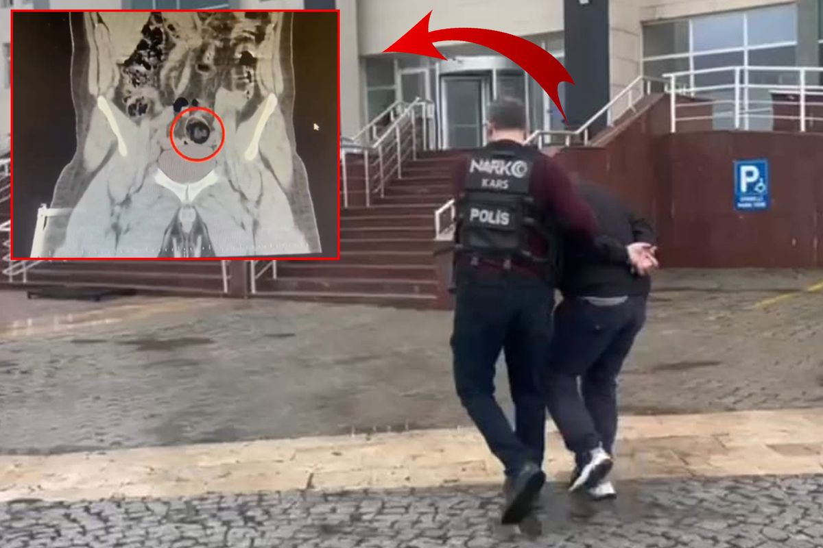 Yolcu otobüsünde İranlı kuryenin makatından uyuşturucu çıktı