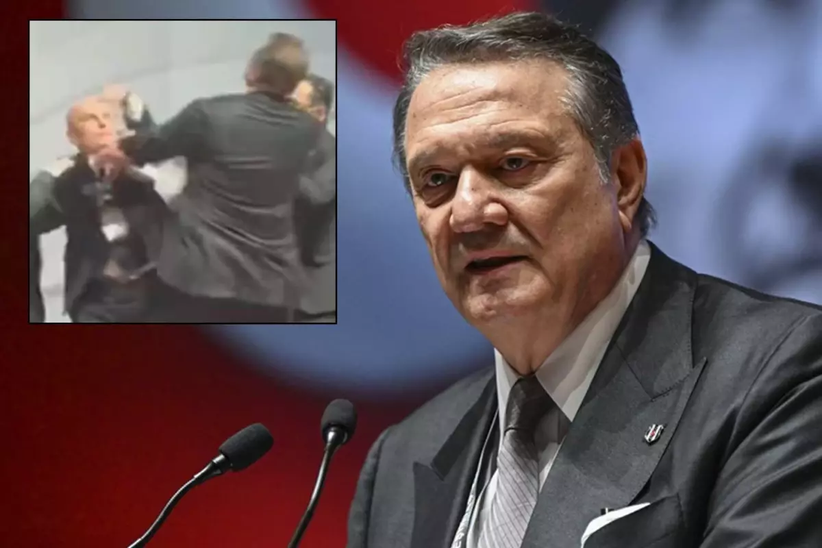 Divan Kurulu'nda yumruklanan Beşiktaş'ın eski başkanı Hasan Arat, darp raporu aldı