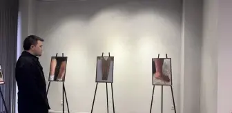 Romatizmal hastalıkların vücuttaki etkileri yapay zeka ile görselleştirildi