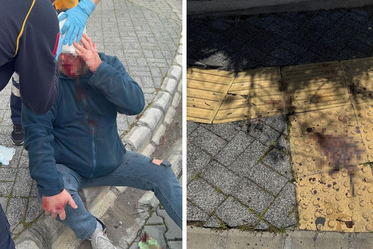 Marmaris'te gazeteciye saldırı da 5 kişi gözaltına alındı