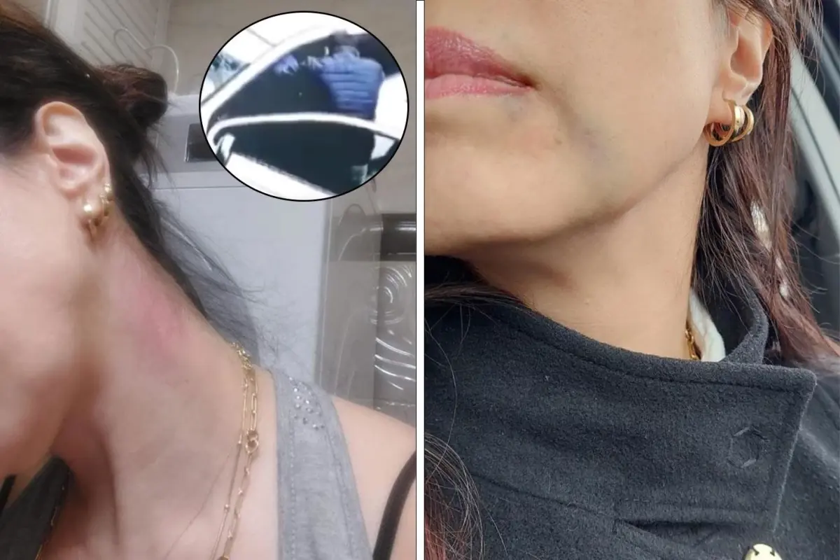 Astım hastası kadını öldüresiye dövdüler: 'Beni öldü zannedip kaçtılar'