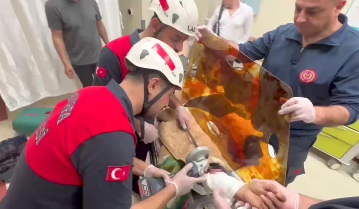 Şanlıurfa'da İşçinin Koluna Demir Şiş Saplandı