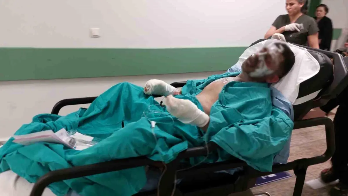 Samsun'da Tinerle Yanan Genç Ağır Yaralandı