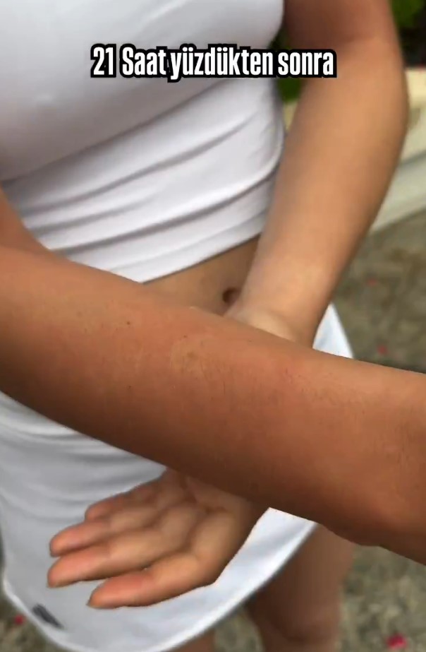 65 kilometre yüzen Aysu Türkoğlu'nun vücudundaki inanılmaz değişim
