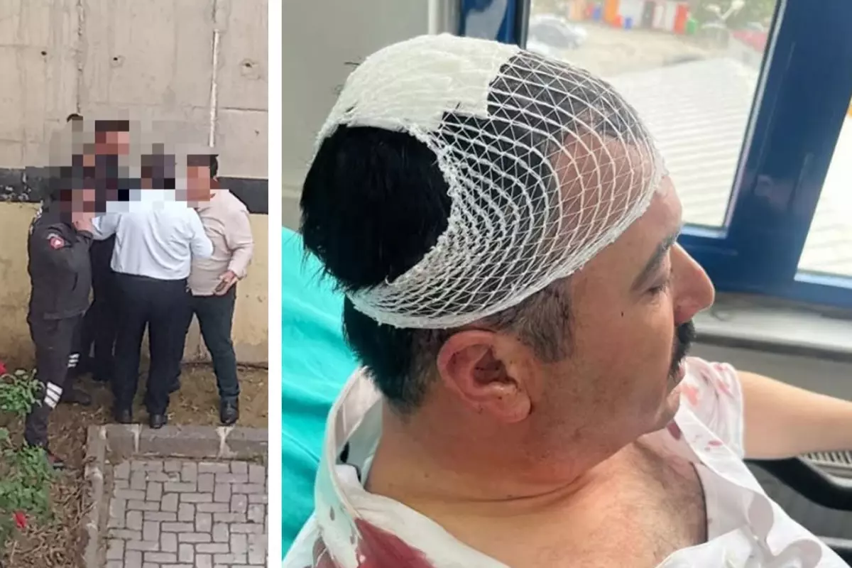 Yeniden Refah Partili başkan yardımcıları arasında kavga: Kafasını şekerlikle parçaladı