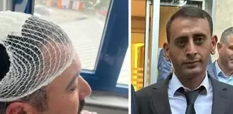 Belediye başkan yardımcısına şekerlikle saldıran Yeniden Refah Partili tutuklandı