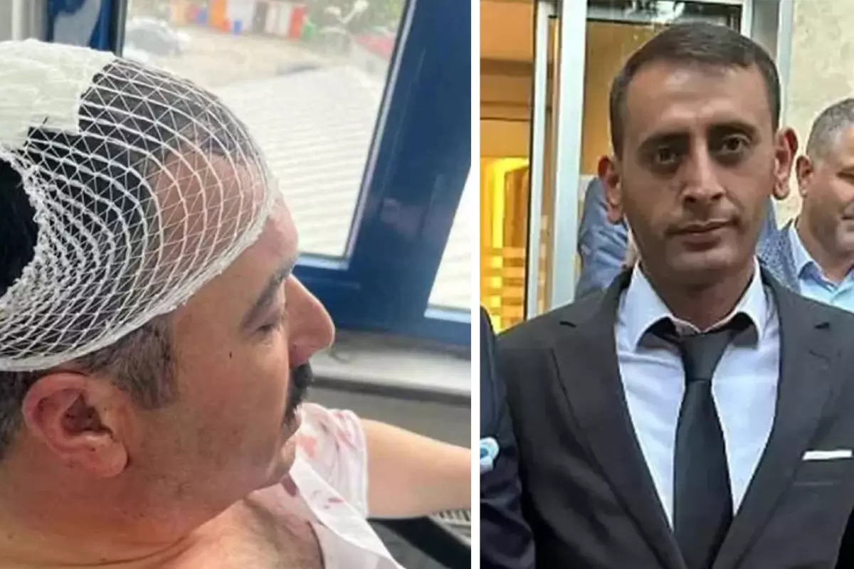 Belediye başkan yardımcısına şekerlikle saldıran Yeniden Refah Partili tutuklandı