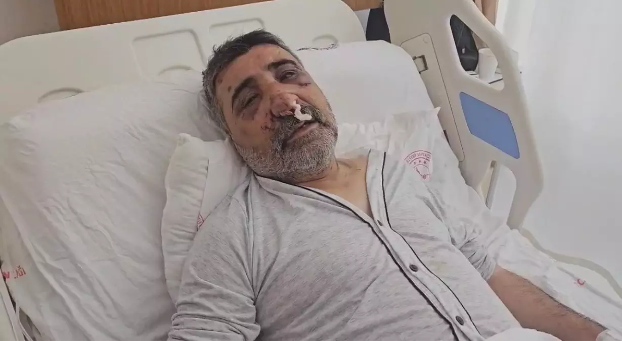 İngiliz Boksör Taksi Şoförüne Saldırdı: Kadir Biçer Yoğun Bakımda