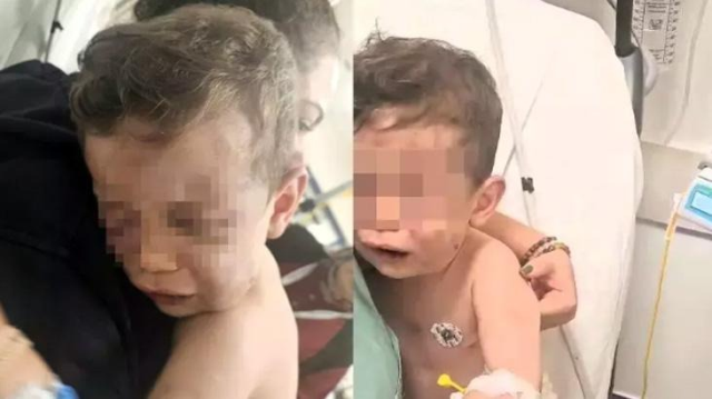 The suspect who brutally assaulted baby Aren has been arrested