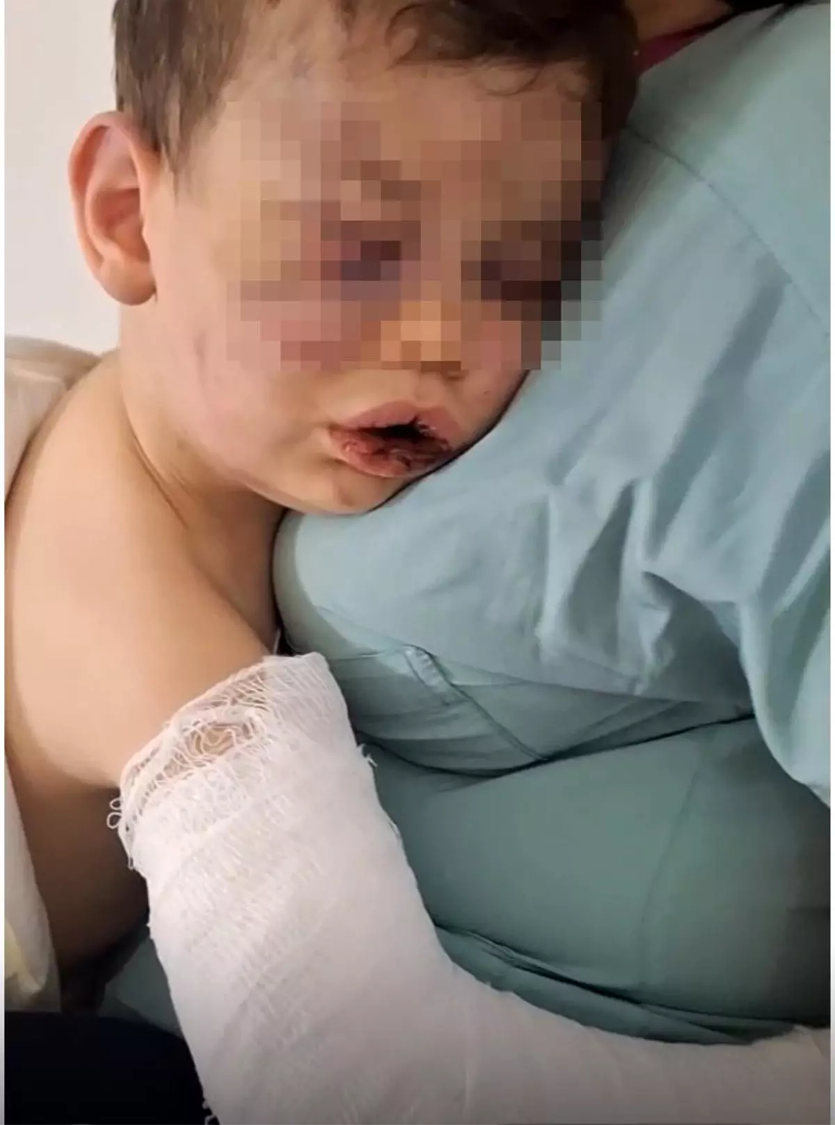 Aile ve Sosyal Hizmetler Bakanlığı'ndan 2 Yaşındaki Çocuğa Devlet Koruması