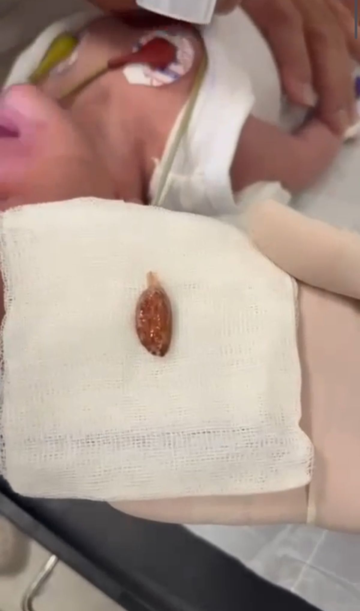 16 Günlük Bebek Badem Şekerine Takıldı