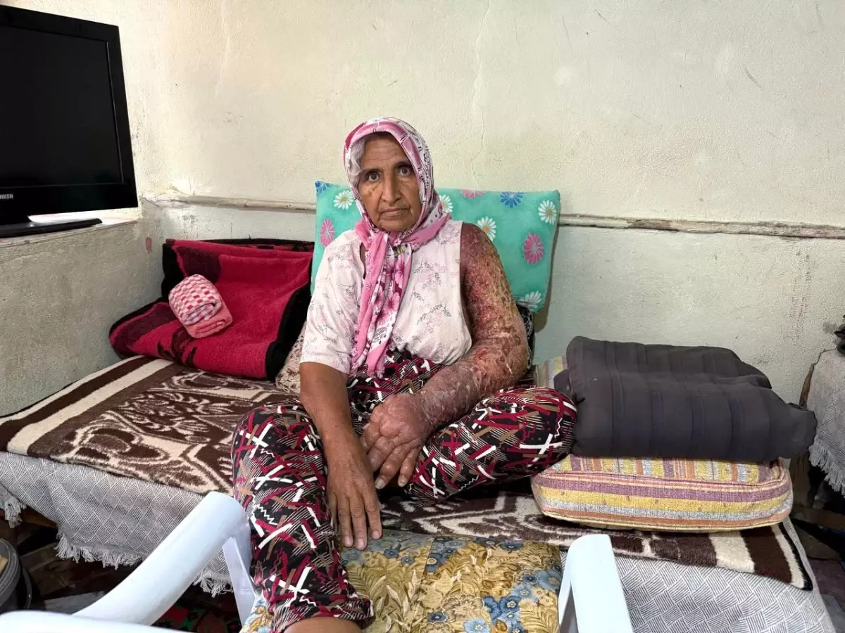 Adana'da 4 Çocuk Annesi Yardım Bekliyor