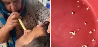 Hindistan değil Adana! Bu saçmalığa inanıp tedavi için gidenler var