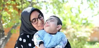 Özel Gereksinimli Çocuklar İçin Tasarım Elbise Üreten Anne
