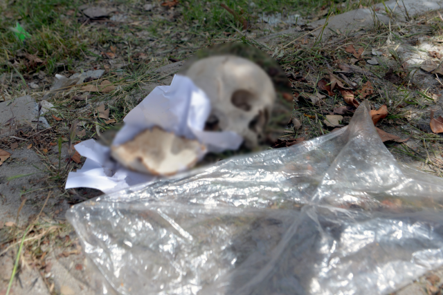 The human skull found in the trash was thrown away by the wife of a specialist doctor