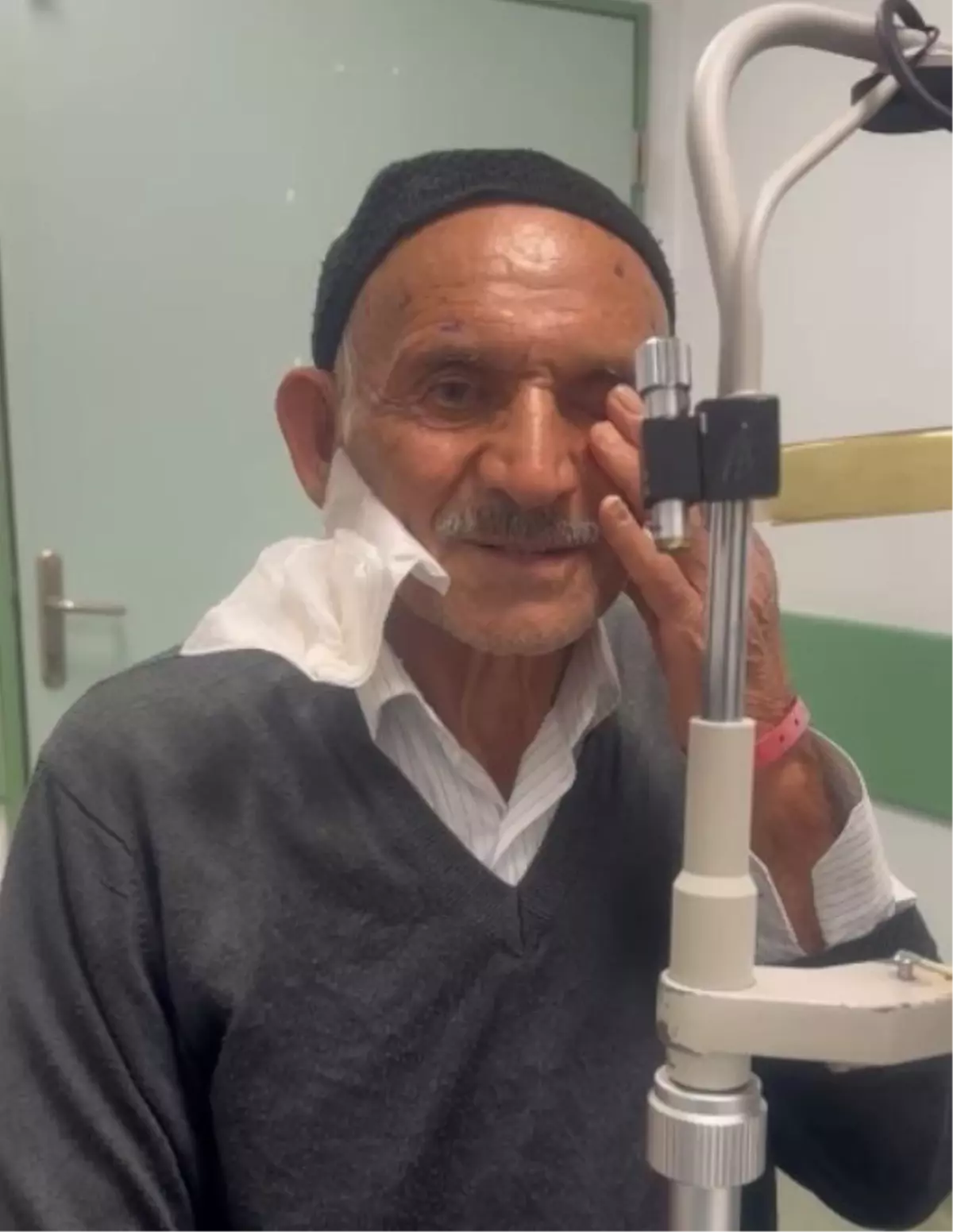 Samsun Hastanesinde İlk Kornea Nakli Başarıyla Gerçekleşti