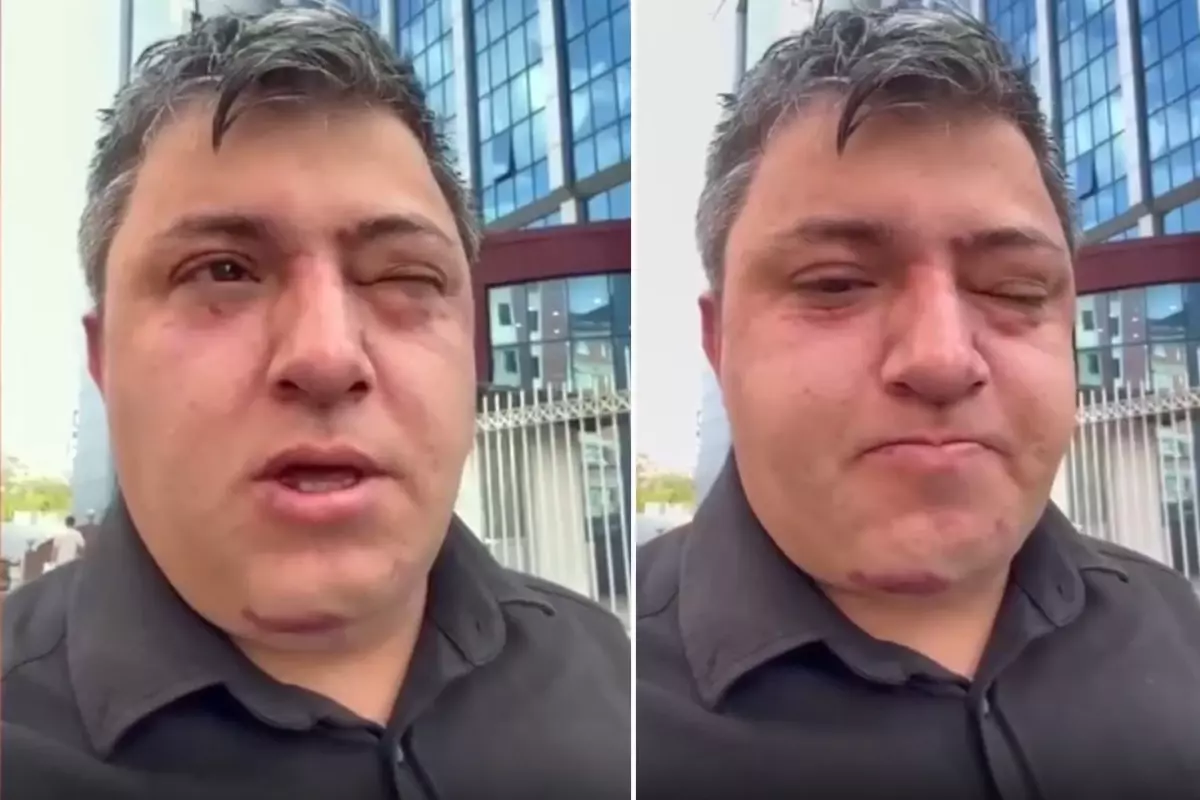 Vahim iddia: Altındağ Belediye Başkanı Tiryaki belediye işçisini darp etti