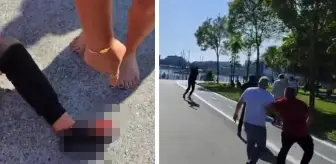 Galatasaraylı taraftar Kadıköy'de silahlı saldırıya uğradı! Sarı-kırmızılılardan açıklama