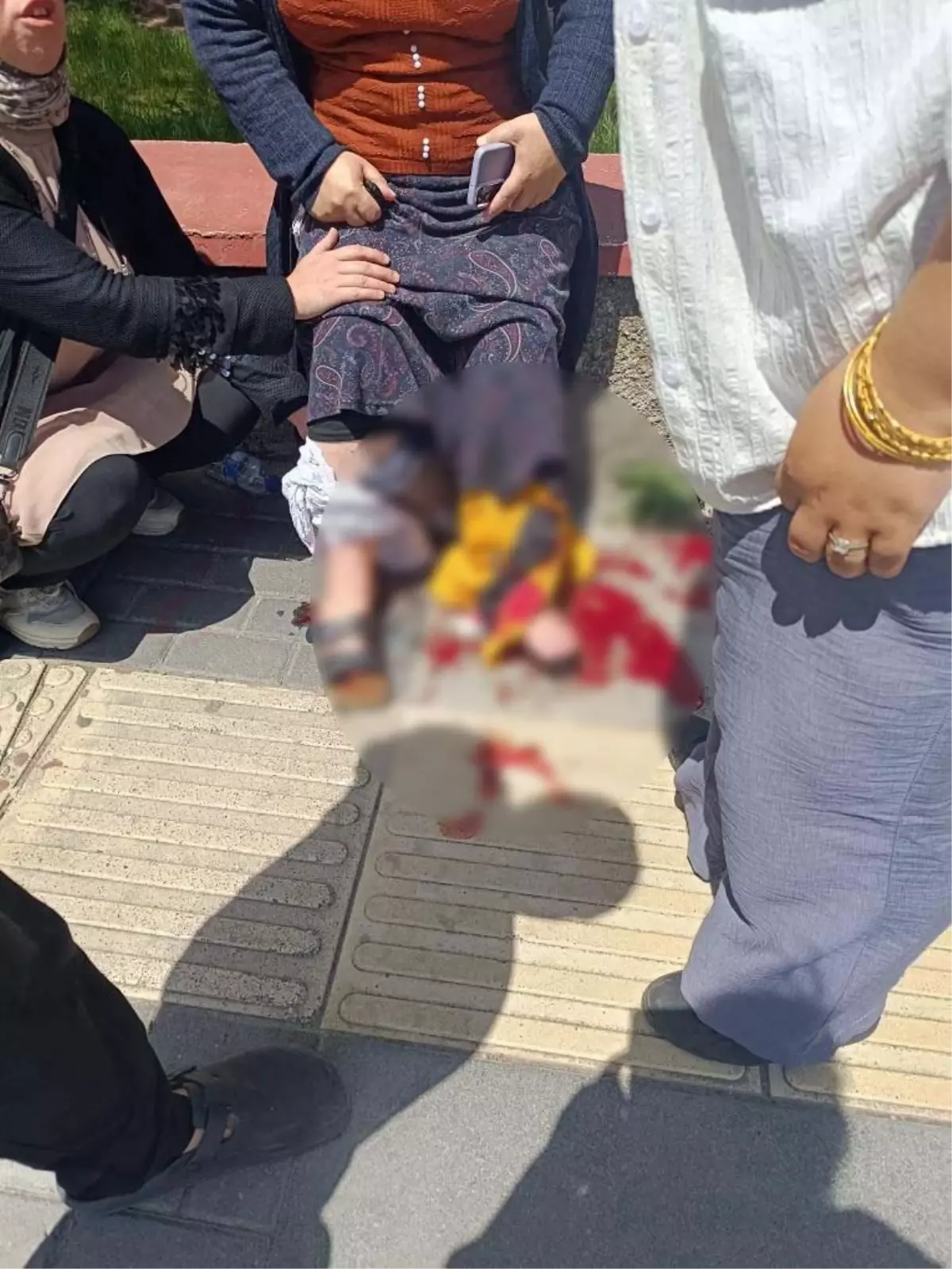 Keçiören'de Silahlı Kavga: Masum Geçici Yaralandı