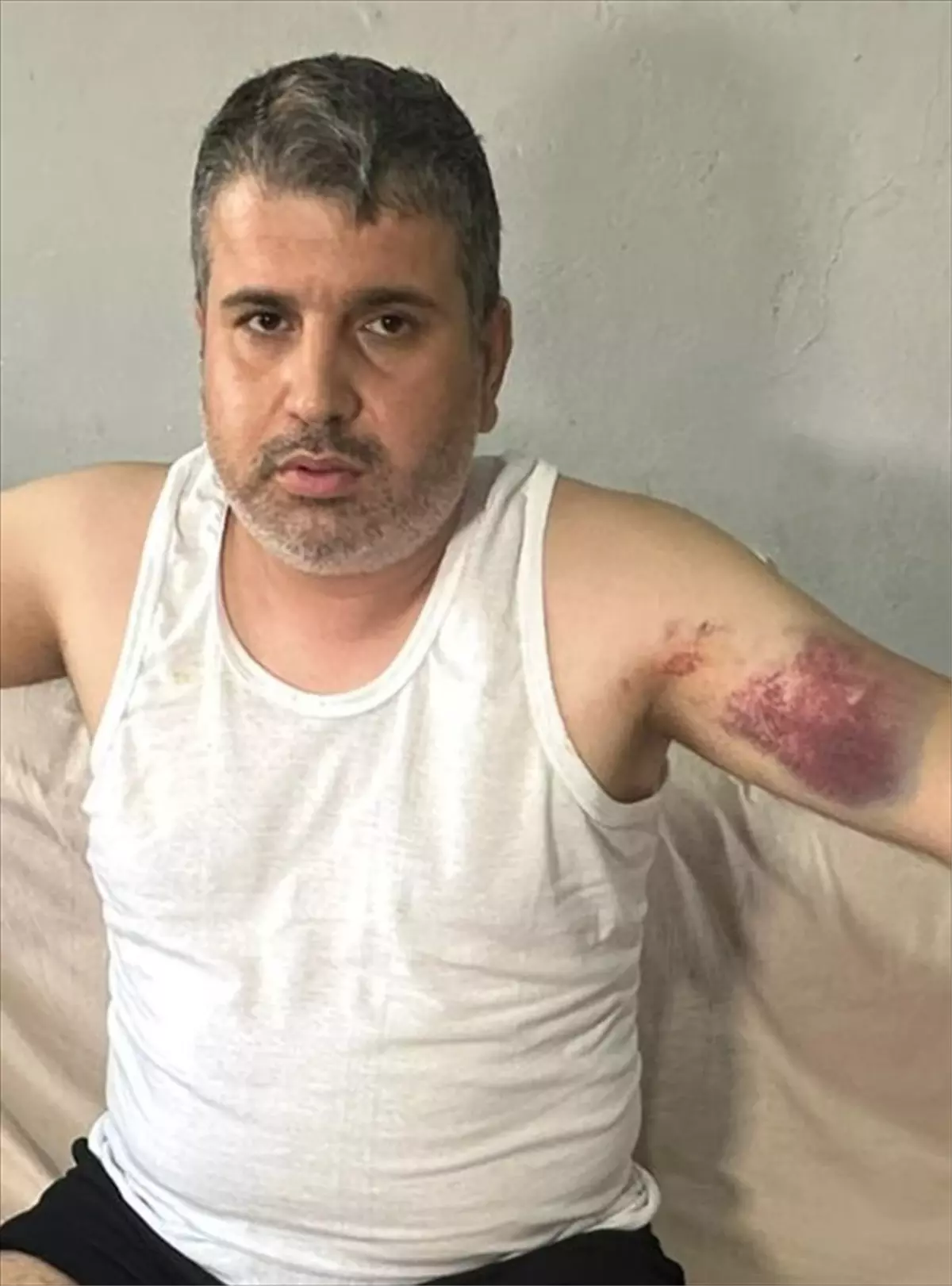 Adana'da Dayısı Tarafından Beyzbol Sopasıyla Darbedilen Kişi Yaralandı