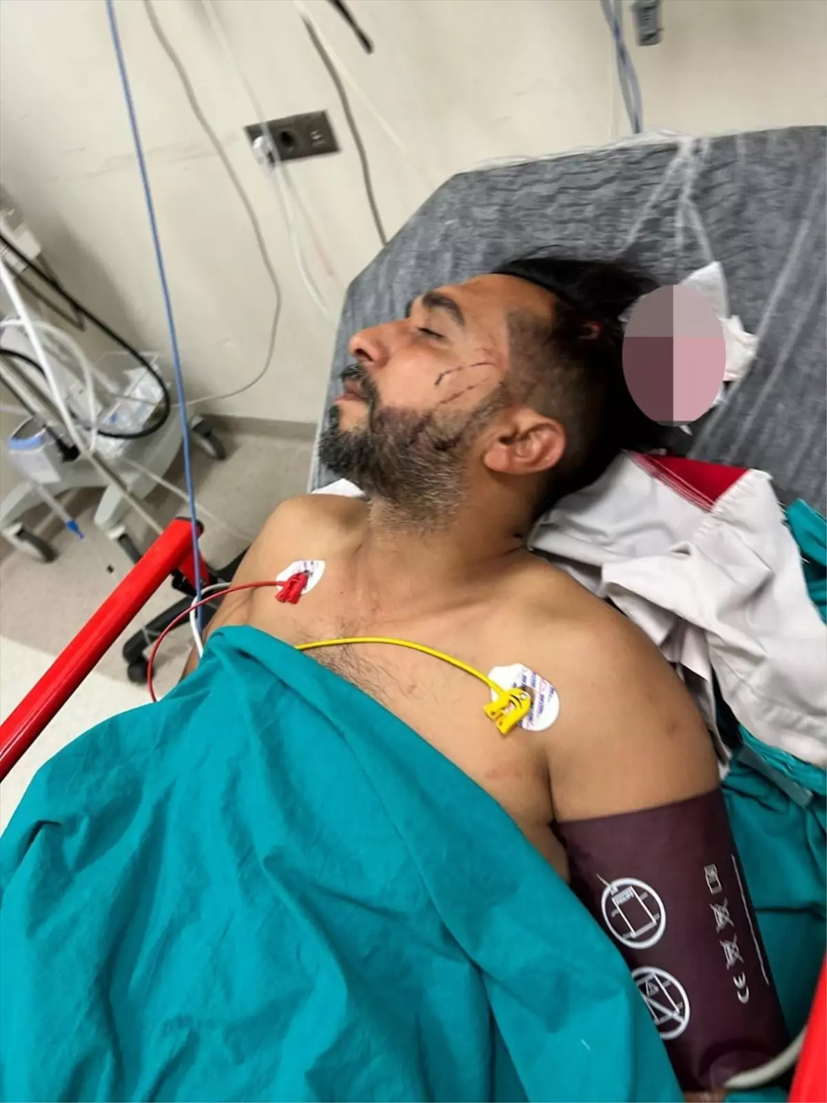 Adana'da Döner Ustasına Yorgun Mermi İsabet Etti
