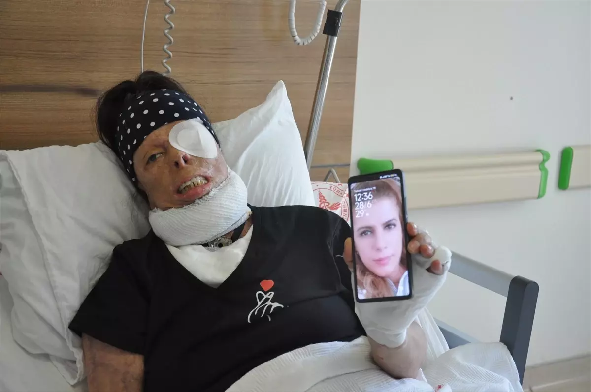 Şiddet Mağduru Yasemin Uzunçelebi'nin Tedavi Süreci Devam Ediyor